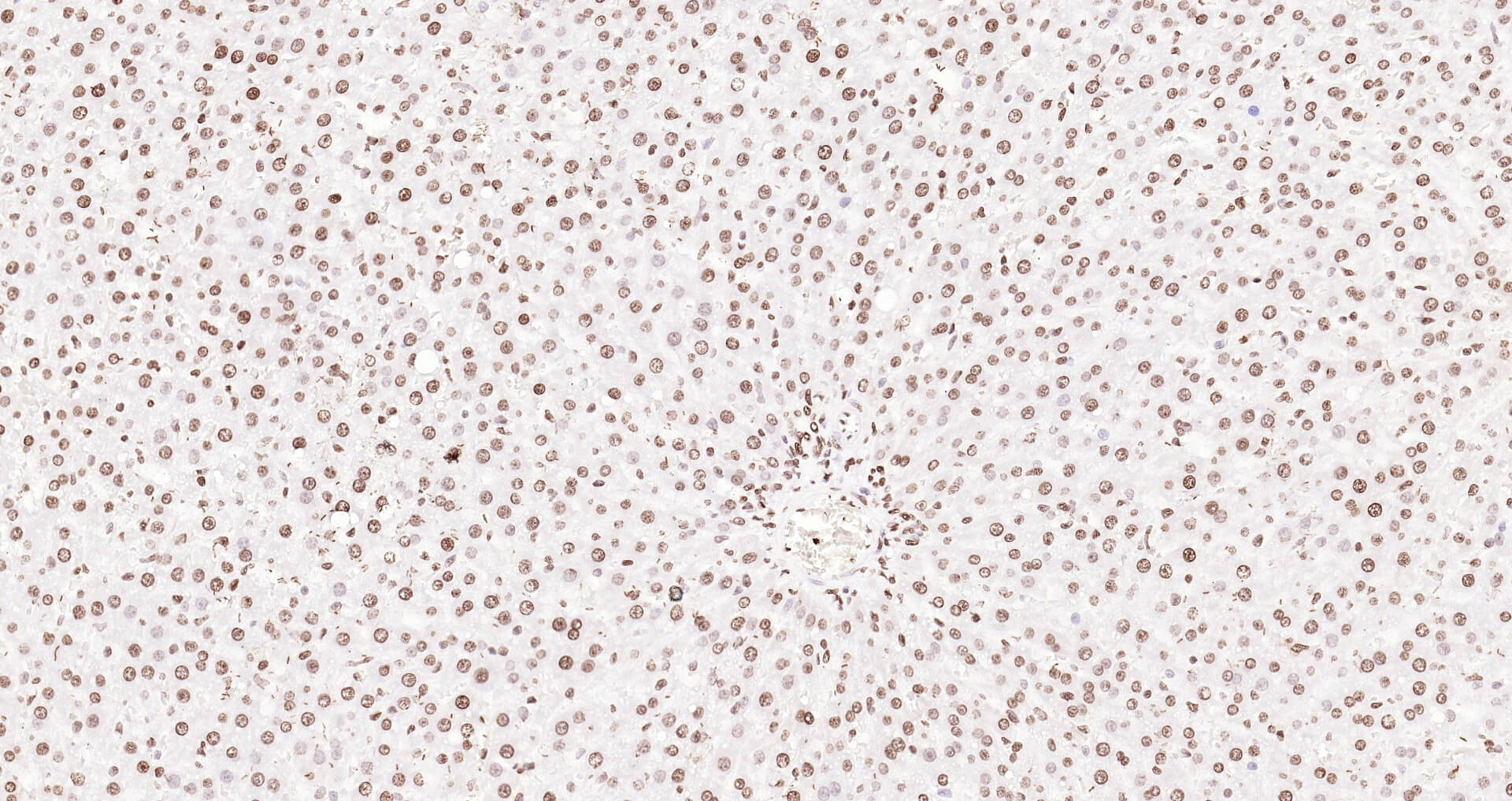 组蛋白H3（核内参）即用型免疫组化试剂盒-IHC0102